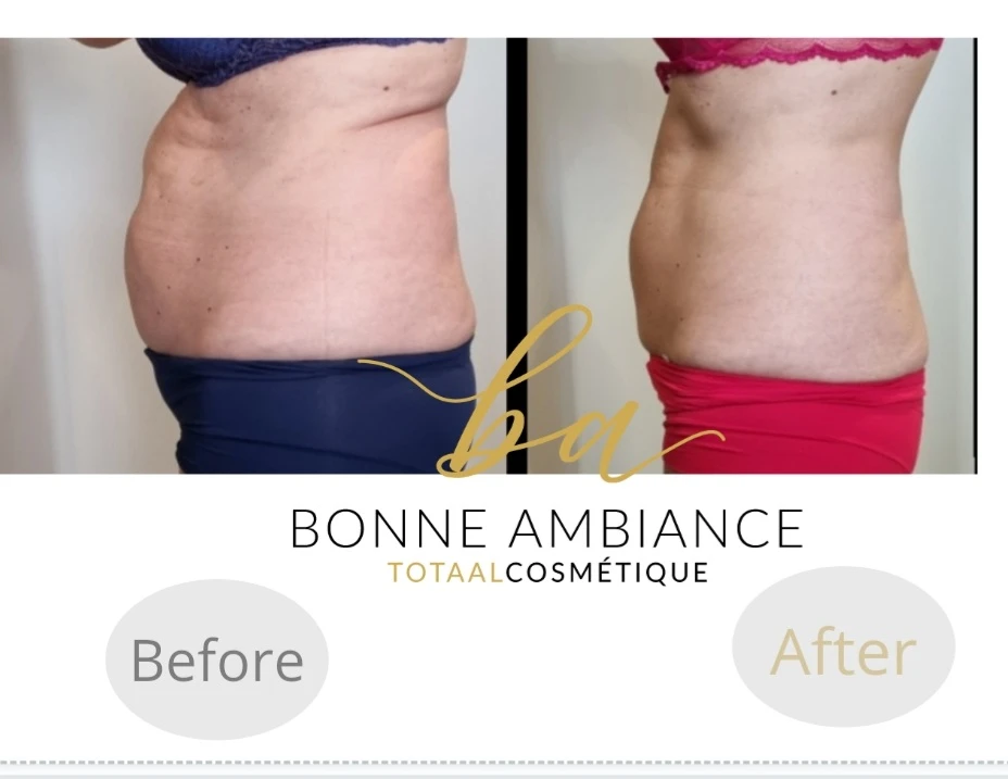 photo - Bonne Ambiance