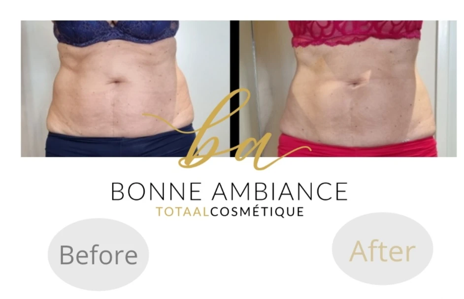 photo - Bonne Ambiance