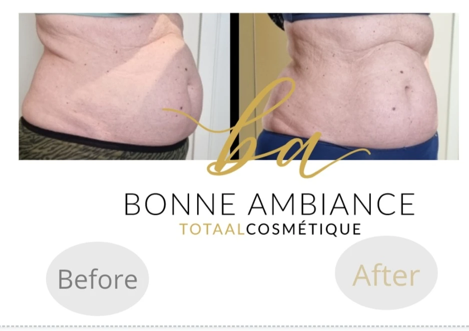 photo - Bonne Ambiance