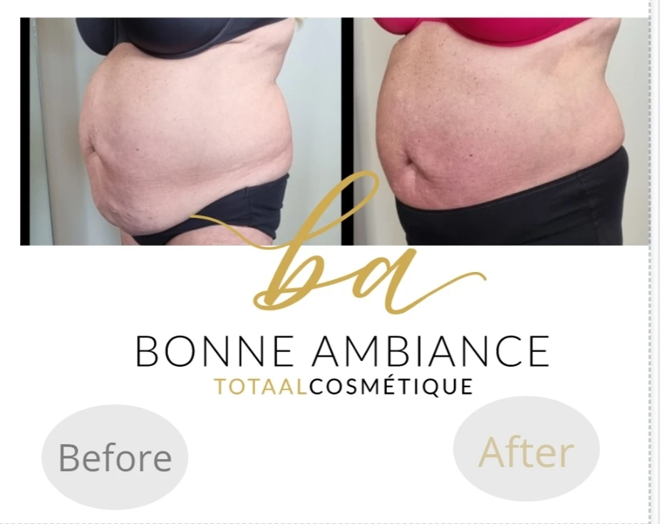 photo - Bonne Ambiance