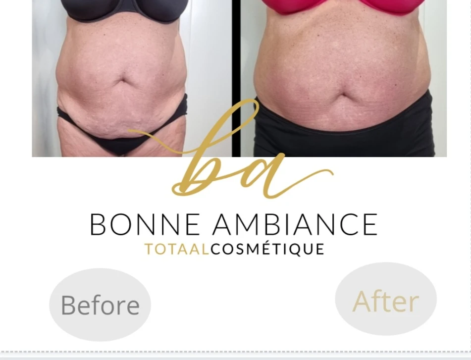 photo - Bonne Ambiance