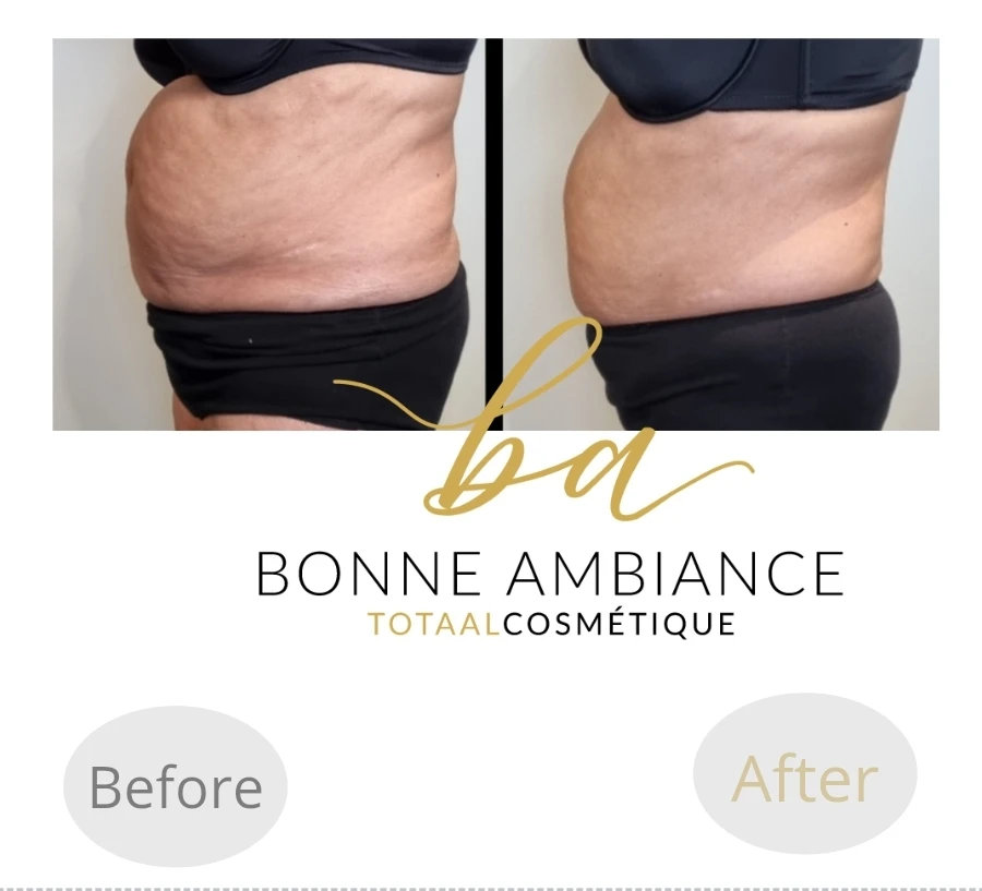 photo - Bonne Ambiance