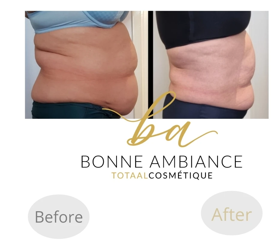 photo - Bonne Ambiance