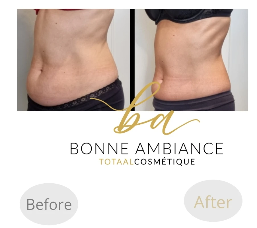 photo - Bonne Ambiance